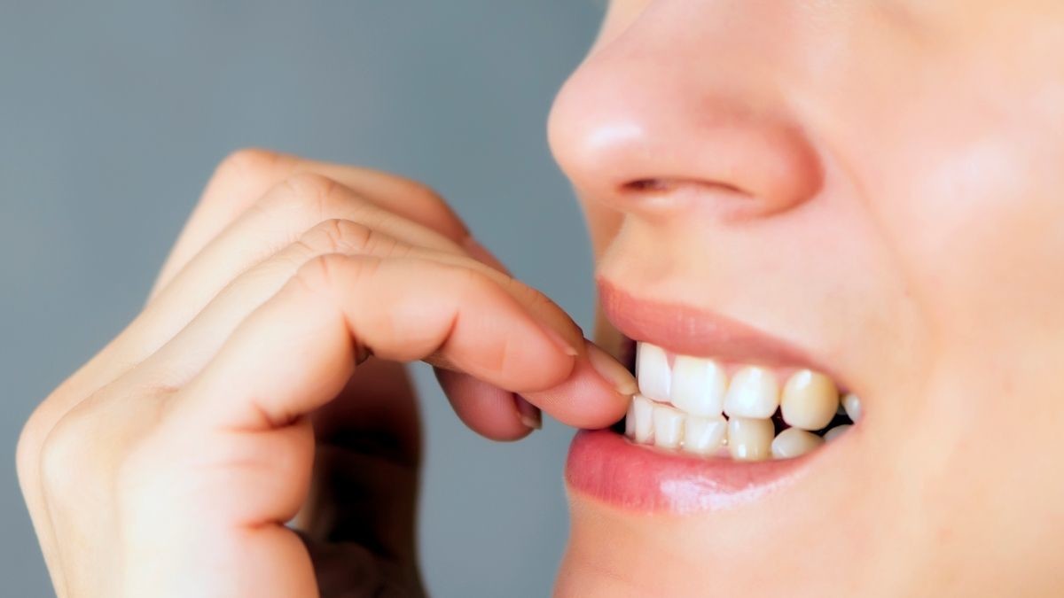 Sering dianggap Sepele, Ternyata 5 Kebiasaan Kecil ini Justru Dapat Merusak Gigimu 2 024063100 1612259228 Efek Buruk Kebiasaan Menggigit Kuku by fotyma Canva
