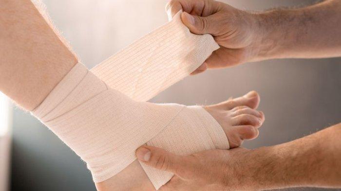 Ilustrasi kompresi atau perban elastis untuk menangani cedera engkel
