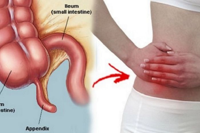 Mitos atau Fakta Makan Biji Jambu Bisa Bikin Usus Buntu? 4 1478977013