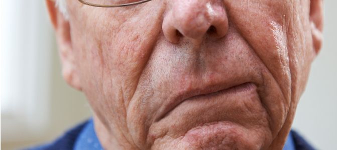 Gejala Stroke yang Harus Diwaspadai: Kenali Tanda Awal Stroke untuk Penanganan Lebih Cepat 2 ukygjpg 20210723050640