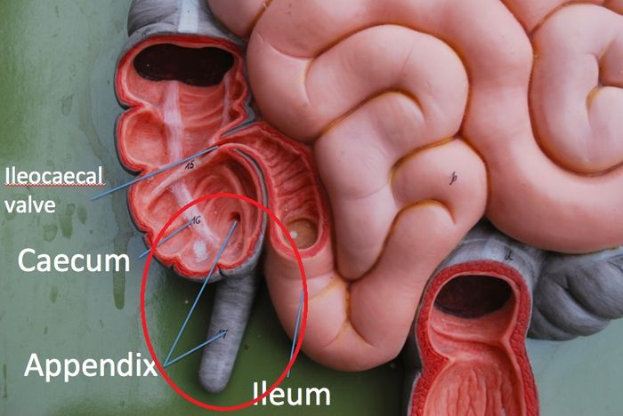 Mitos atau Fakta Makan Biji Jambu Bisa Bikin Usus Buntu? 2 usus buntujpg 20210428090604