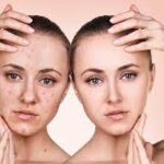 Tips Kulit Sehat dari Dosen Unair saat Kualitas Udara Buruk 5 download 14