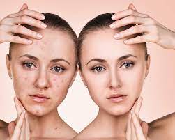 Tips Kulit Sehat dari Dosen Unair saat Kualitas Udara Buruk 1 download 14