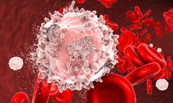 55. leukosit tinggi pada anak 2