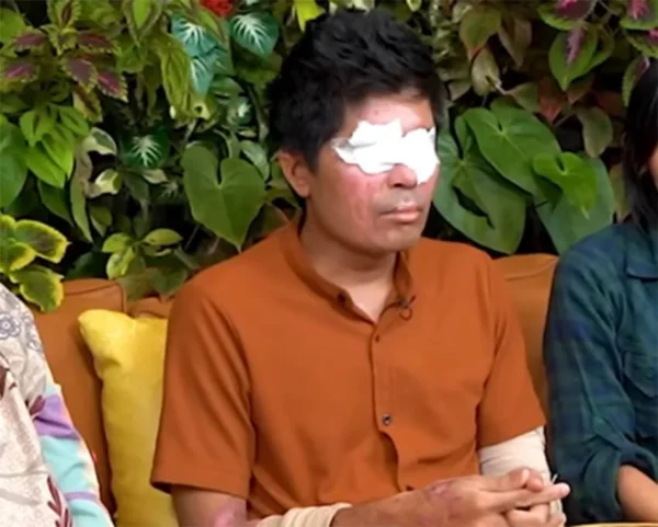 Petisi Donasi Agus Salim Terus Bermunculan