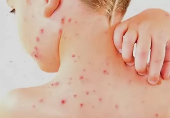 Screenshot 20240521 101038 YouTube 2423412690